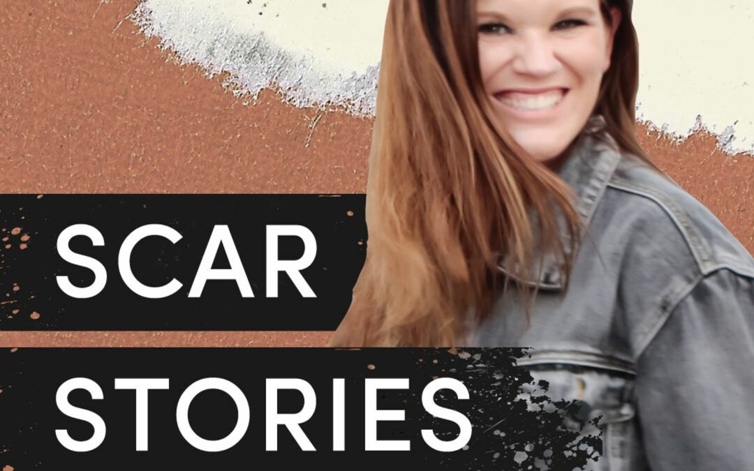 Scar Stories: Emy Vasquez